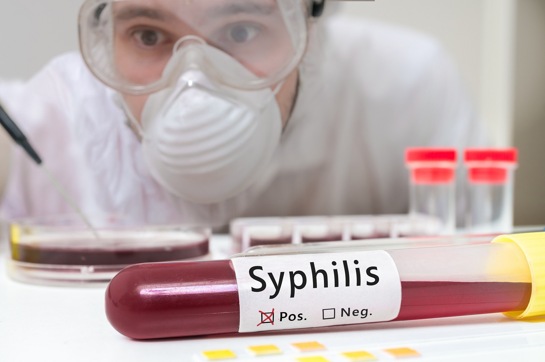 Кровь со следами сифилиса