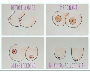 Your Boobs During Pregnancy  Breast Changes in Pregnancy