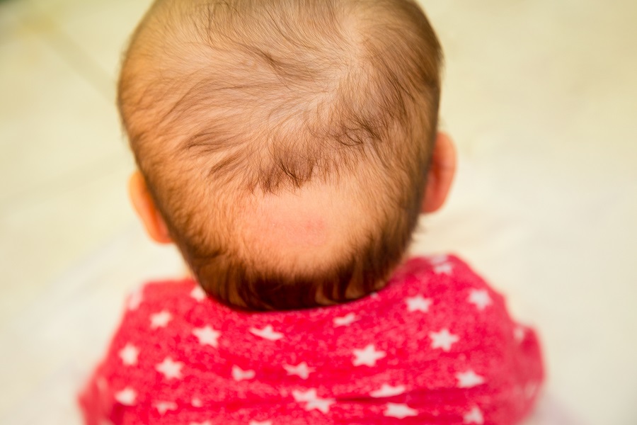 Why Is My Baby Losing Their Hair? - The Pulse